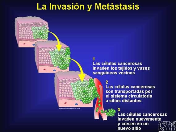 que es la metastasis