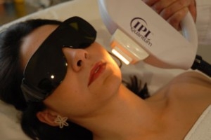 Los mejores tratamientos para tu cuerpo, Tratamientos Faciales IPL (I)